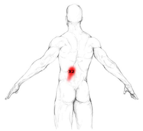 Erector Spinae Muscle Pain Trigger Points