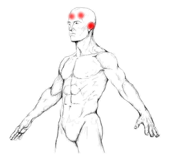 Sternocleidomastoid – Pain & Trigger Points