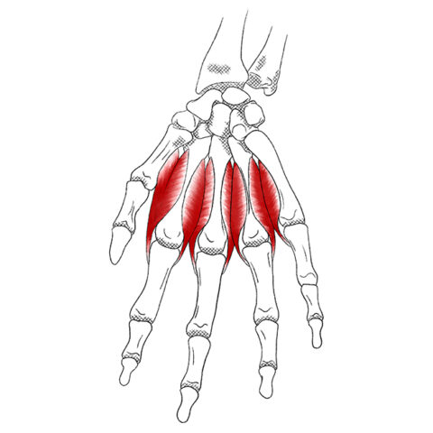 Interossei, Lumbricales & Abductor digiti: Pain & Trigger Points