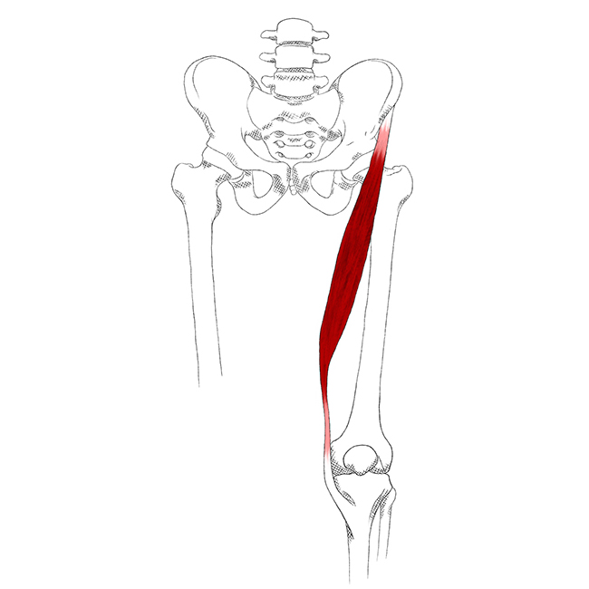 Sartorius – Pain & Trigger Points